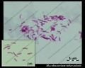 m.tuberculosis, Koch's bacillus, acid fast rods